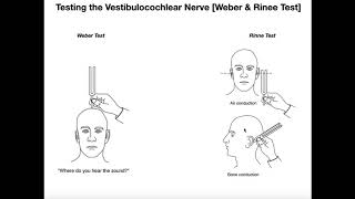 Interpreting the WeberRinne Tests EXPLAINED [upl. by Robillard934]