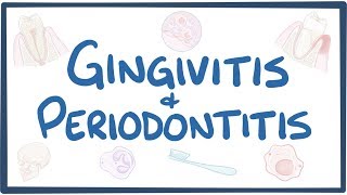 Gingivitis and periodontitis  causes symptoms diagnosis treatment pathology [upl. by Einaej440]