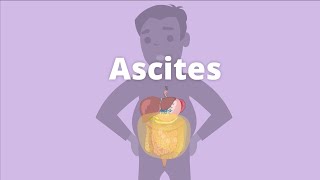 ASCITES  causespathophysiology dx and treatment by DoctScape [upl. by Chemar]