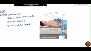 Ascites for USMLE Step 2 [upl. by Yonina650]