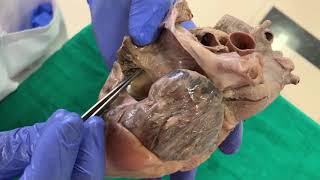 Dissection Interior of right atrium of heart [upl. by Aisha]