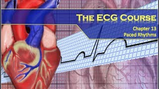 The ECG Course  Paced Rhythms [upl. by Atteroc]