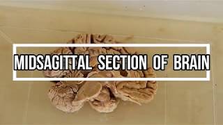 Midsagittal Section of Brain  neuroanatomy [upl. by Auhsohey]