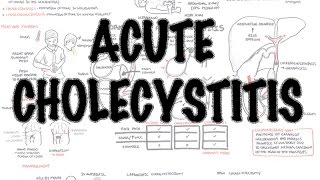 Differential Diagnosis of Ascites [upl. by Metsky973]