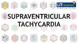 Supraventricular Tachycardia [upl. by Britta]