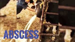 BEST ABSCESS COMPILATION [upl. by Anuska]