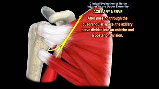 NERVE INJURY IN THE UPPER EXTREMITY Everything You Need To Know  Dr Nabil Ebraheim [upl. by Aehtela]