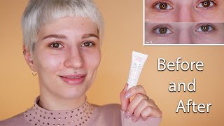 Avene Soothing Eye Contour Cream  Before amp After [upl. by Esinart]